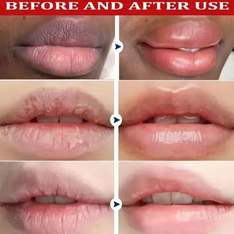 Opulent Lip Renewal Serum Mask — Lightening, Exfoliating & Nourishing