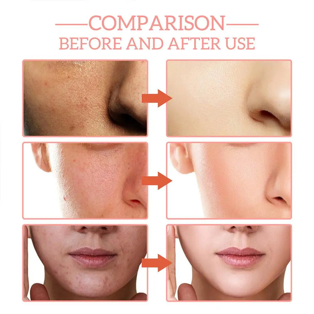 Opulent 5-in-1 Vitamin C & Hyaluronic Brightening Serum
