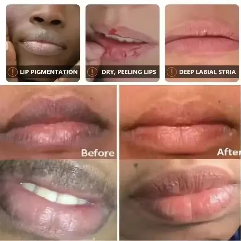 Opulent Lip Renewal Serum Mask — Lightening, Exfoliating & Nourishing