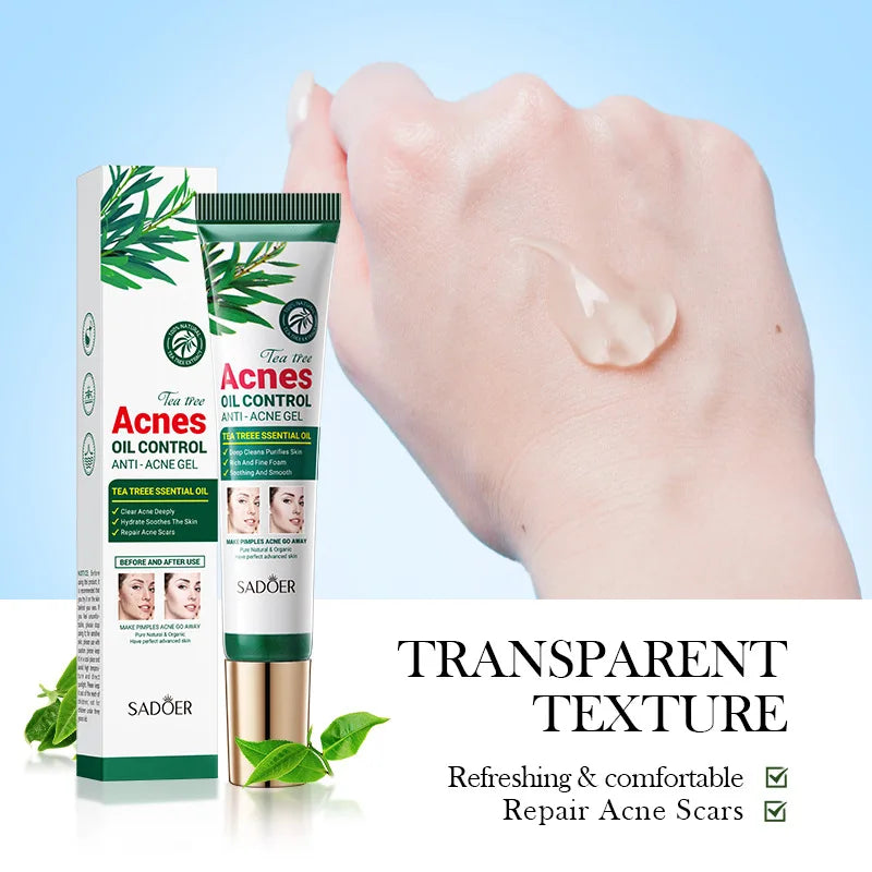 SADOER Tea Tree Purifying Acne Gel Cream — Oil Control & Hydrating